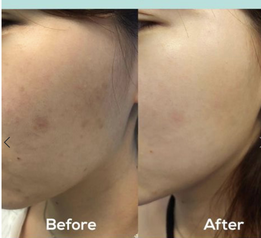 سرم ضد لک اکسیس وای